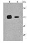 Microtubule Associated Serine/Threonine Kinase 2 antibody, orb215071, Biorbyt, Western Blot image 
