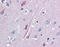 Neurotrophic Receptor Tyrosine Kinase 2 antibody, 51-037, ProSci, Immunohistochemistry frozen image 