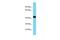 Divergent Protein Kinase Domain 2B antibody, PA5-46135, Invitrogen Antibodies, Western Blot image 