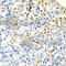 DCMP Deaminase antibody, A5889, ABclonal Technology, Immunohistochemistry paraffin image 