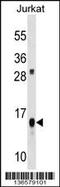 ATP Synthase F1 Subunit Delta antibody, 58-754, ProSci, Western Blot image 