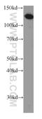 Trafficking Protein Particle Complex 9 antibody, 66131-1-Ig, Proteintech Group, Western Blot image 