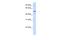 Zinc Finger Protein 275 antibody, A16411, Boster Biological Technology, Western Blot image 