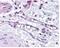 Egl-9 Family Hypoxia Inducible Factor 1 antibody, NB100-137, Novus Biologicals, Immunohistochemistry paraffin image 