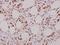 BCL2 Like 1 antibody, A00181S56, Boster Biological Technology, Immunohistochemistry paraffin image 