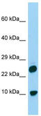 Histone H2A.V antibody, TA331995, Origene, Western Blot image 