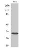 Distal-Less Homeobox 5 antibody, STJ92725, St John