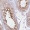 Zinc Finger Protein 101 antibody, NBP2-33755, Novus Biologicals, Immunohistochemistry paraffin image 