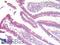 C-C Motif Chemokine Receptor 9 antibody, LS-A959, Lifespan Biosciences, Immunohistochemistry paraffin image 