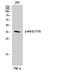 NFKB Inhibitor Beta antibody, A05766T19, Boster Biological Technology, Western Blot image 