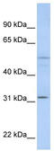 Zinc Finger FYVE-Type Containing 19 antibody, TA339668, Origene, Western Blot image 