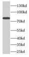 Delta Like Canonical Notch Ligand 4 antibody, FNab02416, FineTest, Western Blot image 