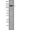 Erbb2 Interacting Protein antibody, PA5-67963, Invitrogen Antibodies, Western Blot image 