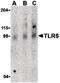 Toll Like Receptor 5 antibody, PA5-20185, Invitrogen Antibodies, Western Blot image 