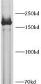 SAM And SH3 Domain Containing 1 antibody, FNab10529, FineTest, Western Blot image 