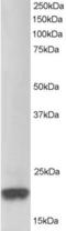 Parkinsonism Associated Deglycase antibody, EB05880, Everest Biotech, Western Blot image 