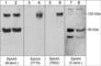 EPH Receptor A4 antibody, EM2801, ECM Biosciences, Western Blot image 