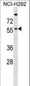 Zinc Finger DHHC-Type Containing 13 antibody, LS-C160758, Lifespan Biosciences, Western Blot image 