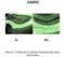 Gamma-Aminobutyric Acid Type A Receptor Delta Subunit antibody, A06694, Boster Biological Technology, Immunohistochemistry paraffin image 