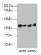 Secretory Carrier Membrane Protein 3 antibody, CSB-PA05195A0Rb, Cusabio, Western Blot image 