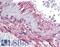 ADP Ribosylation Factor Like GTPase 15 antibody, LS-B4609, Lifespan Biosciences, Immunohistochemistry paraffin image 