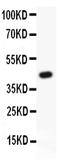 Activating Transcription Factor 2 antibody, PB9131, Boster Biological Technology, Western Blot image 