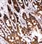 Caspase 6 antibody, PA1441-1, Boster Biological Technology, Immunohistochemistry paraffin image 