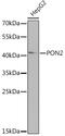 Paraoxonase 2 antibody, GTX65861, GeneTex, Western Blot image 
