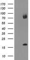 TPD52 Like 3 antibody, LS-C787319, Lifespan Biosciences, Western Blot image 