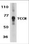 Interleukin-27 receptor subunit alpha antibody, 2483, ProSci Inc, Western Blot image 