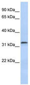 Lactamase Beta 2 antibody, TA345080, Origene, Western Blot image 