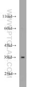 G Protein Subunit Beta 3 antibody, 10081-1-AP, Proteintech Group, Western Blot image 