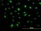 Zinc Finger E-Box Binding Homeobox 2 antibody, H00009839-M03, Novus Biologicals, Immunofluorescence image 