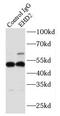 EH Domain Containing 2 antibody, FNab02675, FineTest, Immunoprecipitation image 