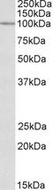 Chloride Voltage-Gated Channel 2 antibody, EB09983, Everest Biotech, Western Blot image 