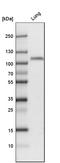 Thrombomodulin antibody, HPA002982, Atlas Antibodies, Western Blot image 