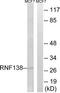 Ring Finger Protein 138 antibody, TA315477, Origene, Western Blot image 