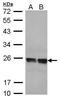 Transgelin 2 antibody, PA5-30271, Invitrogen Antibodies, Western Blot image 