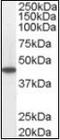 Acyl-CoA Dehydrogenase Medium Chain antibody, orb88620, Biorbyt, Western Blot image 