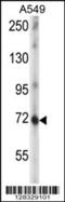 Zinc Finger Protein 429 antibody, 56-742, ProSci, Western Blot image 