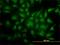 Y-Box Binding Protein 1 antibody, H00004904-M01, Novus Biologicals, Immunofluorescence image 