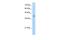 V-Set And Immunoglobulin Domain Containing 4 antibody, GTX47141, GeneTex, Western Blot image 