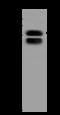 Keratin 78 antibody, 204997-T32, Sino Biological, Western Blot image 
