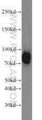 Spartin antibody, 13791-1-AP, Proteintech Group, Western Blot image 