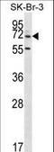 Zinc Finger Protein 398 antibody, LS-C160868, Lifespan Biosciences, Western Blot image 