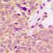 Insulin Receptor Substrate 1 antibody, LS-C368390, Lifespan Biosciences, Immunohistochemistry paraffin image 