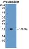 Interferon Gamma antibody, LS-C697163, Lifespan Biosciences, Western Blot image 