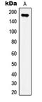 Insulin Receptor Substrate 1 antibody, MBS821003, MyBioSource, Western Blot image 