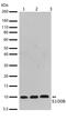 S100 Calcium Binding Protein B antibody, 710363, Invitrogen Antibodies, Western Blot image 