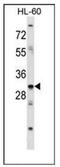 Homeobox B9 antibody, AP52081PU-N, Origene, Western Blot image 
